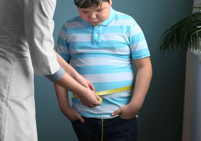 Childhood Obesity Causes Behind the Common Problem